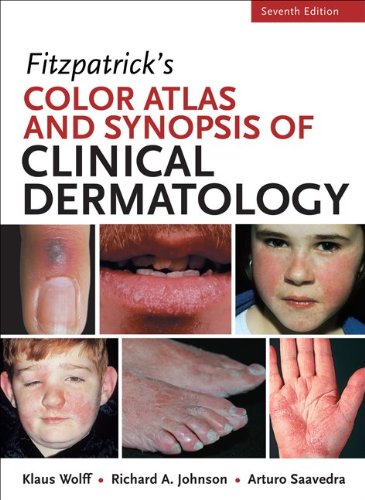 Fitzpatricks Color Atlas and Synopsis of Clinical Dermatology 7th