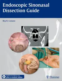 Endoscopic Sinonasal Dissection Guide (Original PDF from Publisher)