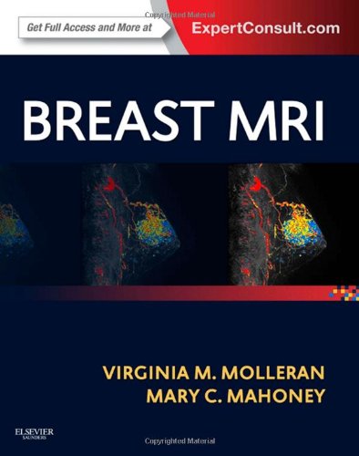Breast MRI, Expert Consult - Online and Print