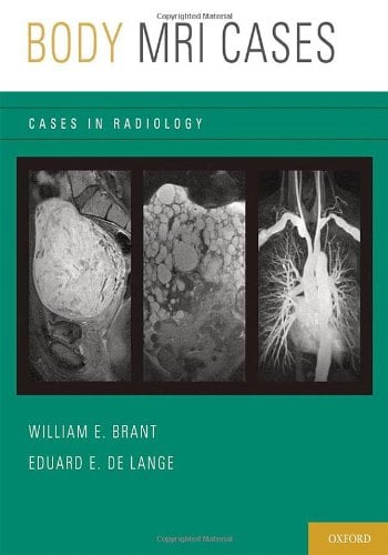 Body MRI Cases (Cases in Radiology)