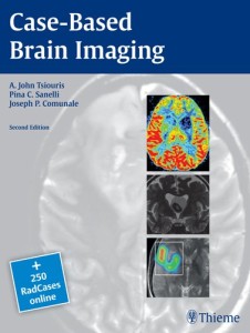 Case-Based Brain Imaging 2nd