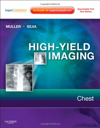High-Yield Imaging - Chest, Expert Consult - Online and Print, 1e (HIGH YIELD in Radiology)
