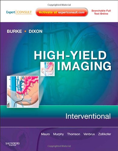 High-Yield Imaging - Interventional, Expert Consult - Online and Print, 1e (HIGH YIELD in Radiology)