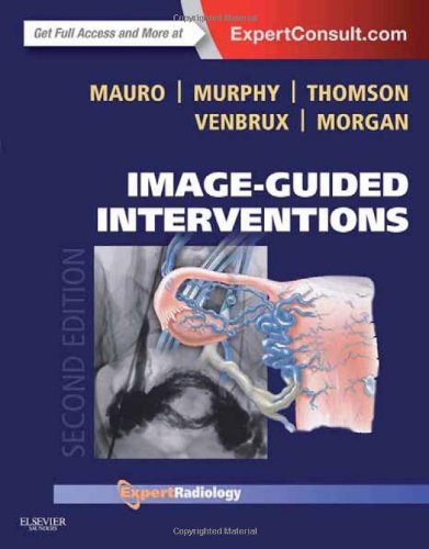Image-Guided Interventions - Expert Radiology Series (Expert Consult - Online and Print), 2e