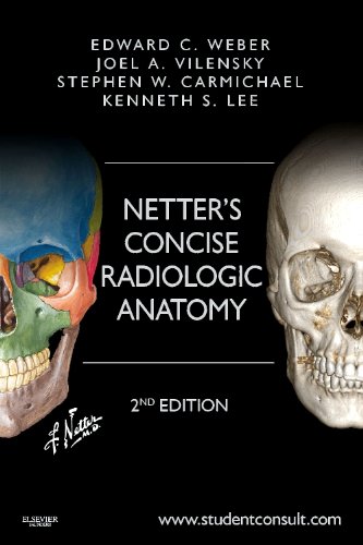 Netter's Concise Radiologic Anatomy, With STUDENT CONSULT Online Access, 2e (Netter Basic Science)