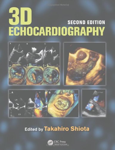 3D Echocardiography, 2nd Edition