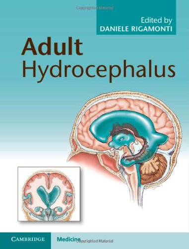 Adult Hydrocephalus (Cambridge Medicine)