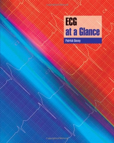ECG at a Glance