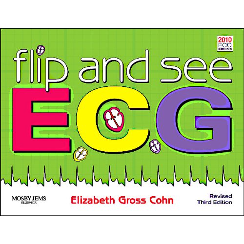 Flip and See ECGs - Revised Reprint, 3e
