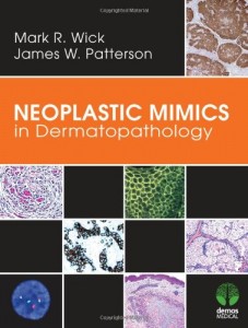 Neoplastic Mimics in Dermatopathology (Pathology of Neoplastic Mimics)