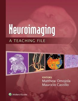 Neuroimaging: A Teaching File (EPUB)