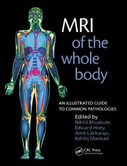 MRI of the Whole Body: An Illustrated Guide for Common Pathologies