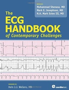 The ECG Handbook of Contemporary Challenges (ORIGINAL PDF from Publisher)