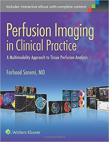 Perfusion Imaging in Clinical Practice: A Multimodality Approach to Tissue Perfusion Analysis (EPUB)