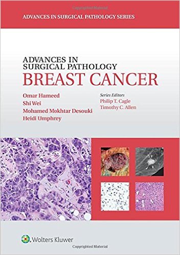 Advances in Surgical Pathology: Breast Cancer (EPUB)