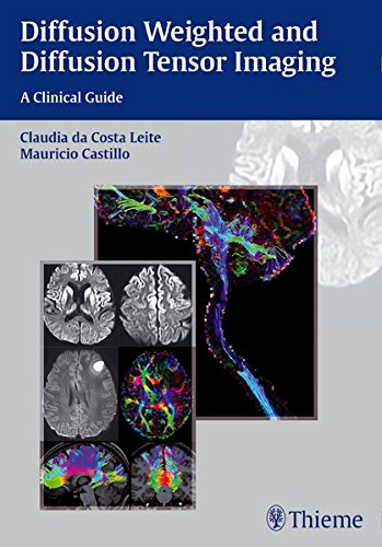 Diffusion Weighted and Diffusion Tensor Imaging: A Clinical Guide (ORIGINAL PDF from Publisher)