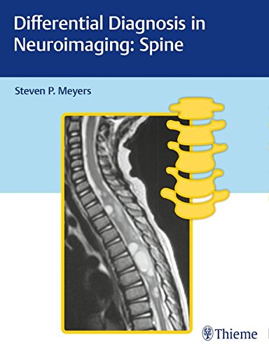 Differential Diagnosis in Neuroimaging: Spine (PDF)