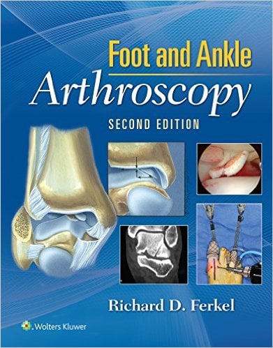Foot & Ankle Arthroscopy, 2nd Edition (EPUB)