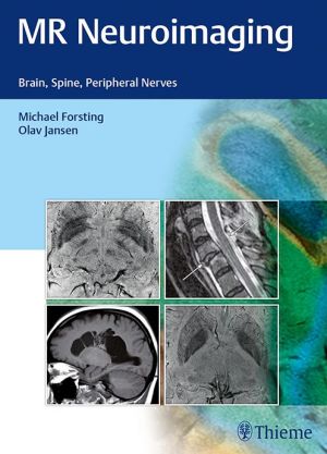 MR Neuroimaging: Brain, Spine, and Peripheral Nerves (EPUB)