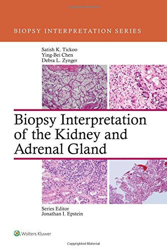 Biopsy Interpretation of the Kidney & Adrenal Gland (Biopsy Interpretation Series) (EPUB)