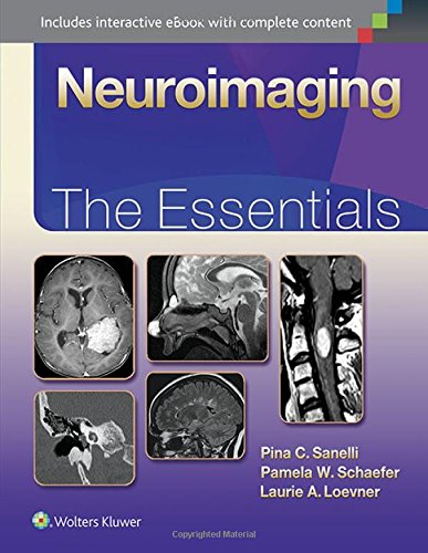 Neuroimaging: The Essentials (Essentials series) (EPUB)