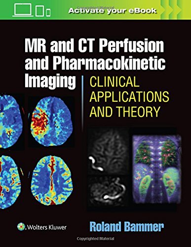 MR and CT Perfusion and Pharmacokinetic Imaging: Clinical Applications and Theoretical Principles (EPUB)