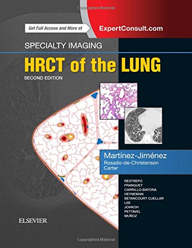 Specialty Imaging: Hrct Of The Lung, 2Nd Edition (Epub)