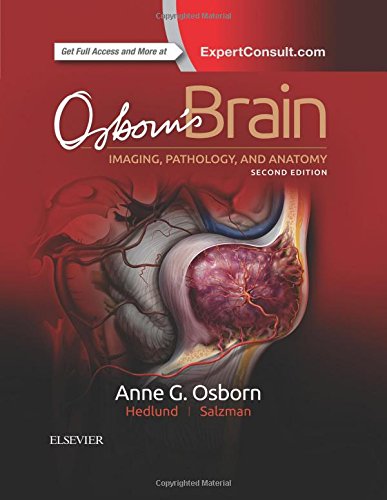 Osborn's Brain, 2nd Edition (PDF)