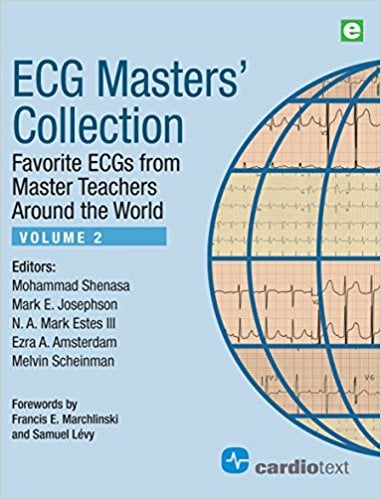 ECG Masters' Collection, Volume 2: Favorite ECGs from Master Teachers Around the World (Original PDF from Publisher)