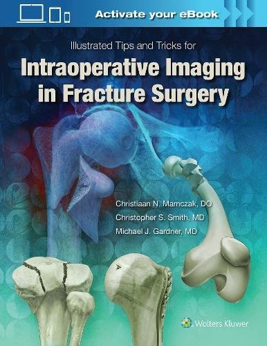 Illustrated Tips And Tricks For Intraoperative Imaging In Fracture Surgery (Epub)