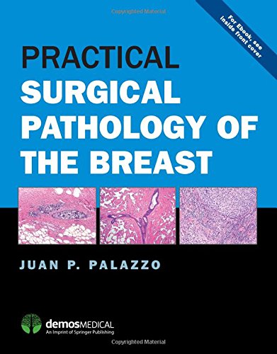Practical Surgical Pathology of the Breast (EPUB)