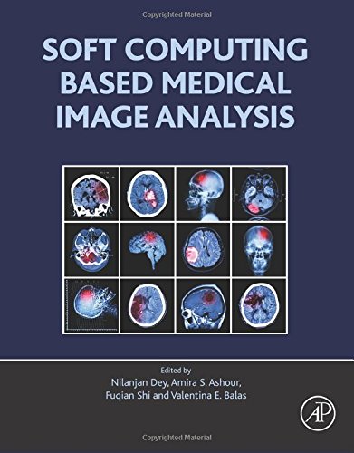 Soft Computing Based Medical Image Analysis (EPUB)