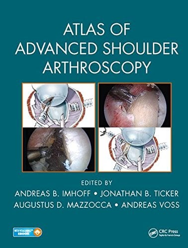 Atlas of Advanced Shoulder Arthroscopy (PDF)