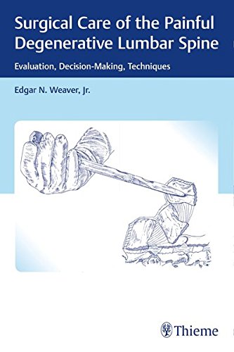Surgical Care of the Painful Degenerative Lumbar Spine: Evaluation, Decision-Making, Techniques (Original PDF from Publisher)