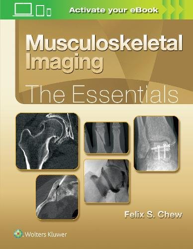 Musculoskeletal Imaging: The Essentials (ePUB)