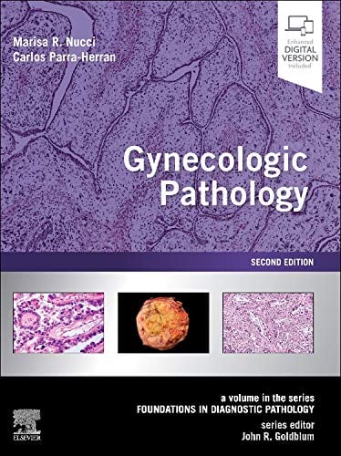 Gynecologic Pathology: A Volume in Foundations in Diagnostic Pathology Series, 2nd Edition (EPUB)