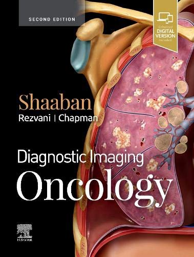 Diagnostic Imaging: Oncology, 2nd Edition (EPUB)