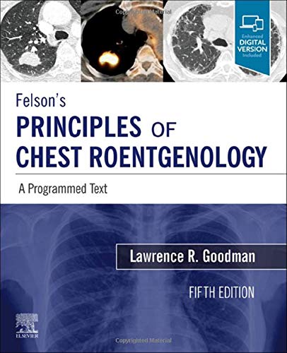 Felson's Principles of Chest Roentgenology, A Programmed Text: A Programmed Text (PDF+Videos)
