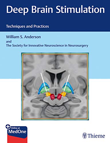 Deep Brain Stimulation: Techniques and Practices (Original PDF from Publisher)
