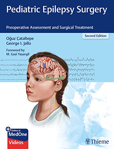 Pediatric Epilepsy Surgery: Preoperative Assessment and Surgical Treatment, 2nd Edition (Original PDF from Publisher)