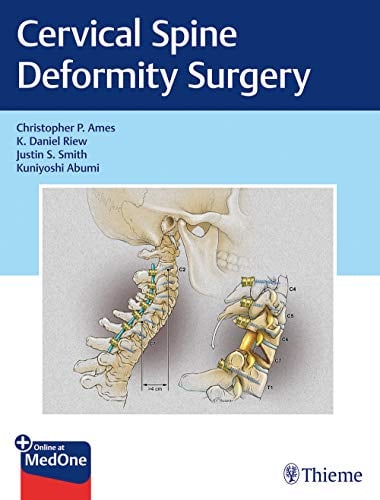 Cervical Spine Deformity Surgery (Original PDF from Publisher)
