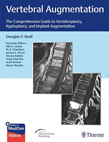 Vertebral Augmentation: The Comprehensive Guide to Vertebroplasty, Kyphoplasty, and Implant Augmentation (Original PDF from Publisher)