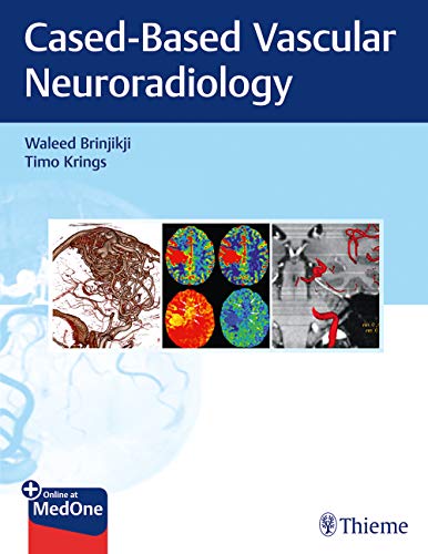 Imaging in Neurovascular Disease: A Case-Based Approach (Original PDF from Publisher)