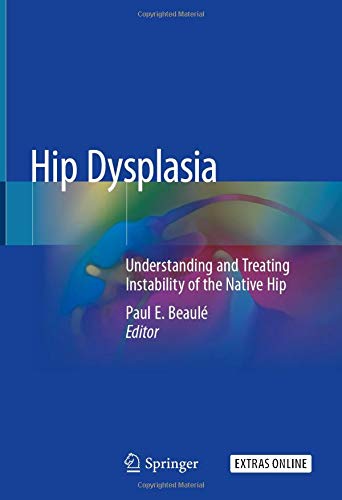 Hip Dysplasia: Understanding and Treating Instability of the Native Hip (Original PDF from Publisher)
