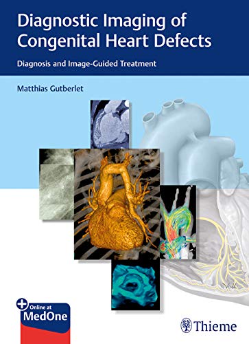 Diagnostic Imaging of Congenital Heart Defects: Diagnosis and Image-Guided Treatment (Original PDF from Publisher)