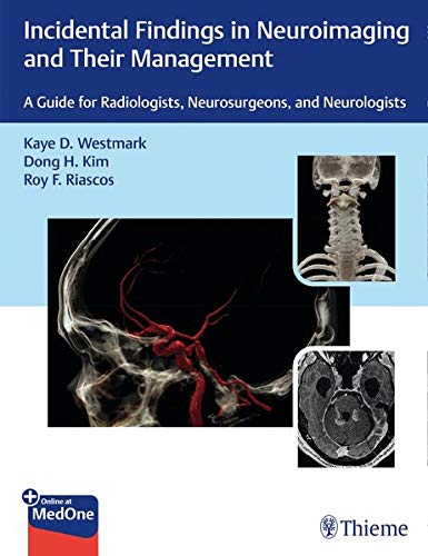 Incidental Findings in Neuroimaging and Their Management: A Guide for Radiologists, Neurosurgeons, and Neurologists (Original PDF from Publisher)