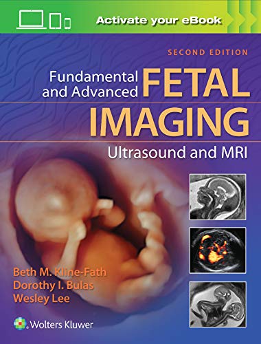 Fundamental and Advanced Fetal Imaging Ultrasound and MRI, 2ed (ePub)