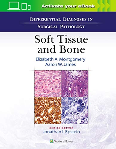 Differential Diagnoses in Surgical Pathology: Soft Tissue and Bone (ePub)