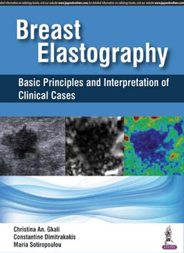 Breast Elastography: Basic Principles and Interpretation of Clinical Cases (Original PDF from Publisher)