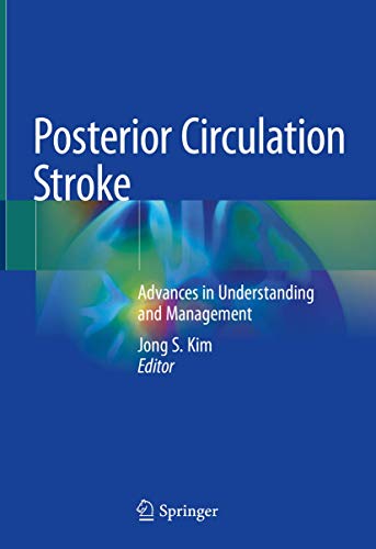 Posterior Circulation Stroke: Advances in Understanding and Management (Original PDF from Publisher)